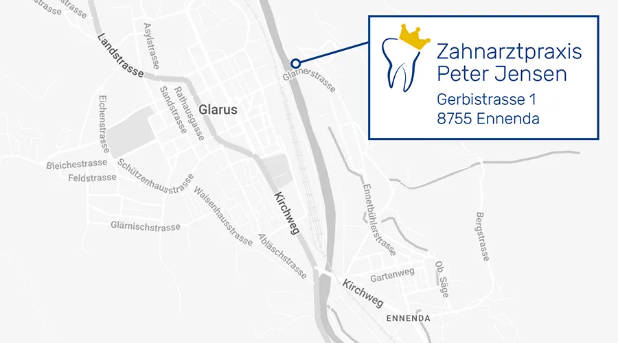 Zahnarztpraxis-Peter-Jensen_Karte-Ennenda